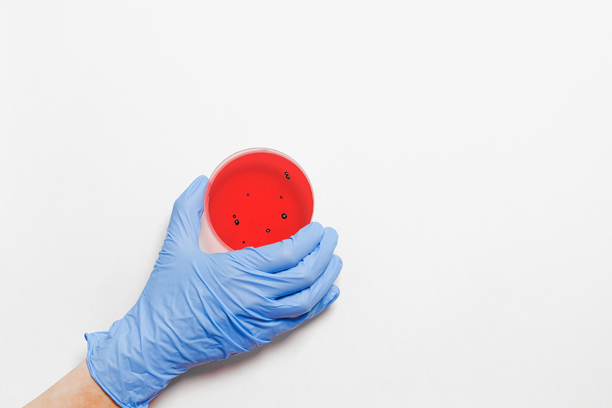 Why We Need Preservative in Our Skincare Products
