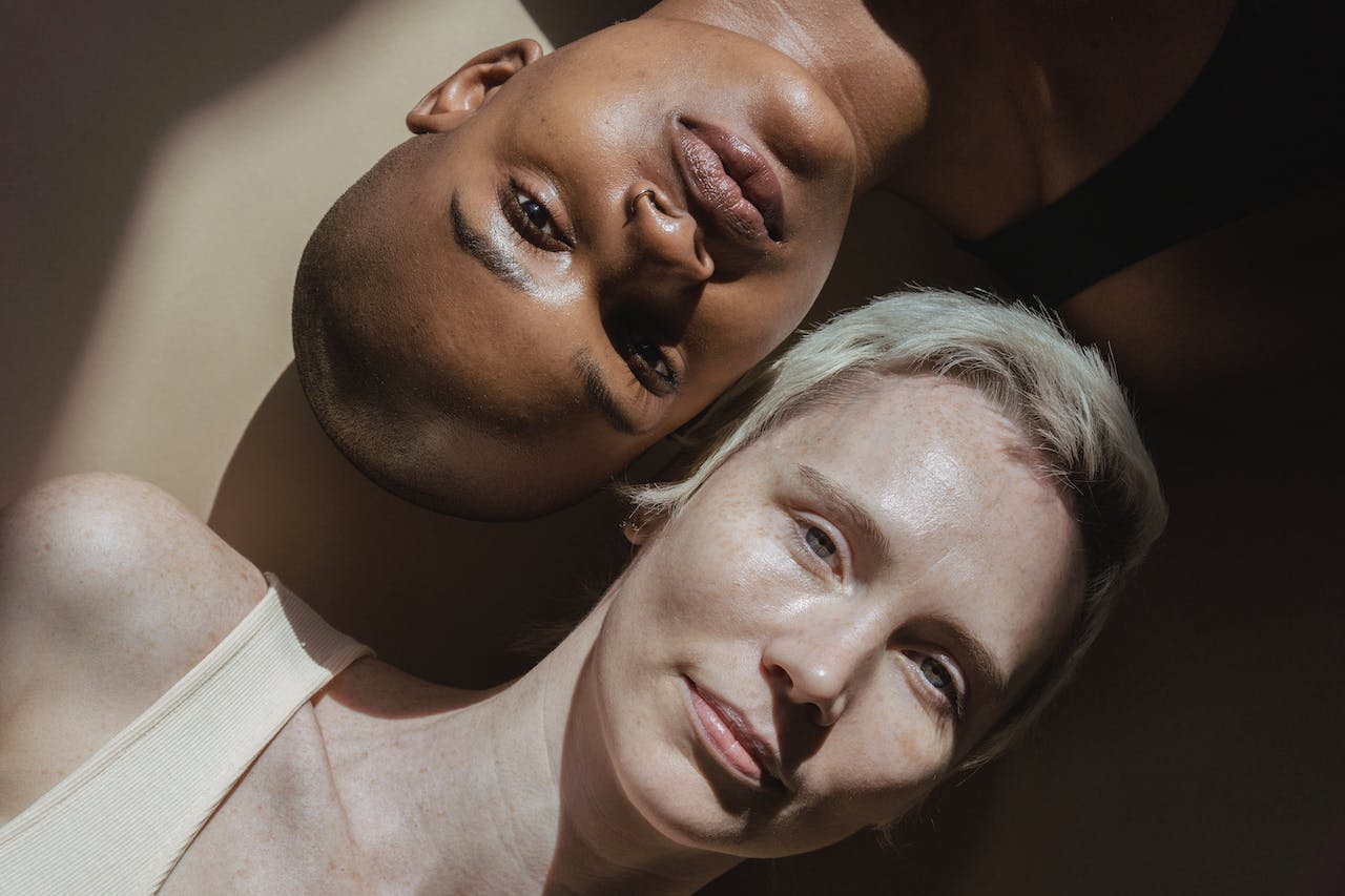 Understanding Hyperpigmentation on Your Skin